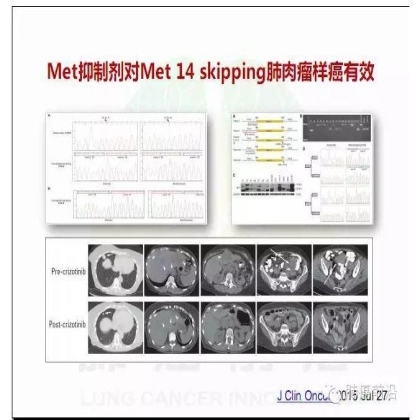 肺癌新分期和分类--临床和研究启示