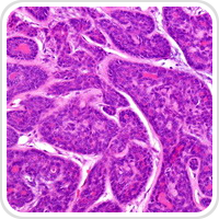 Webpathology.com-镜像翻译（自学使用，版权归原网站所有）