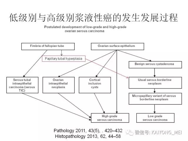 卵巢癌的病理诊断新进展（一）