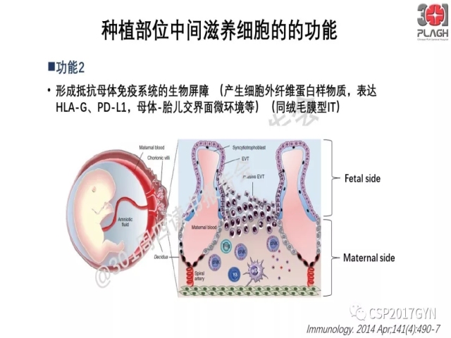 中间型滋养细胞肿瘤的诊断及鉴别诊断