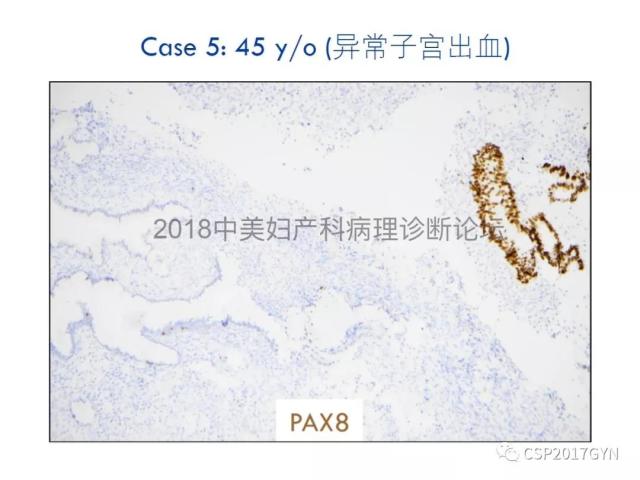 女性生殖道发育