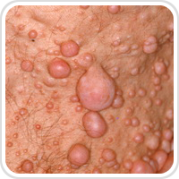 Webpathology.com-镜像翻译（自学使用，版权归原网站所有）