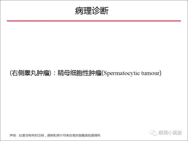 泌尿病理--精原细胞瘤VS精母细胞瘤