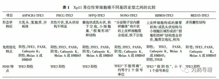 MiT家族易位性肾细胞癌