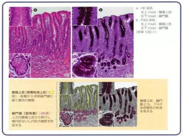 医学美图：胃病理基础概述