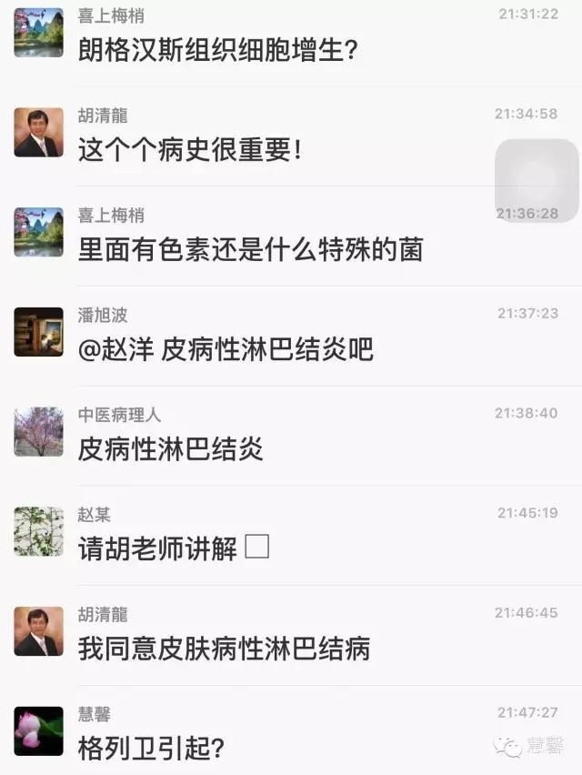 皮病性淋巴结炎，与格列卫治疗相关？（赵洋病例分享，华夏病理学术二群讨论）