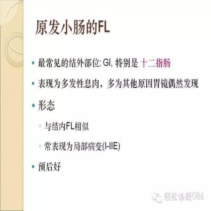 滤泡性淋巴瘤