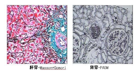 特殊染色室内质量控制