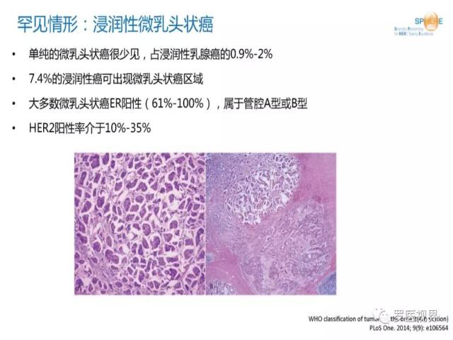 2018 ASCO/CAP乳腺癌HER2检测指南更新解读