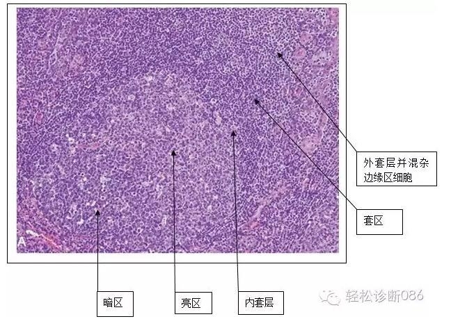 淋巴滤泡的组织学结构