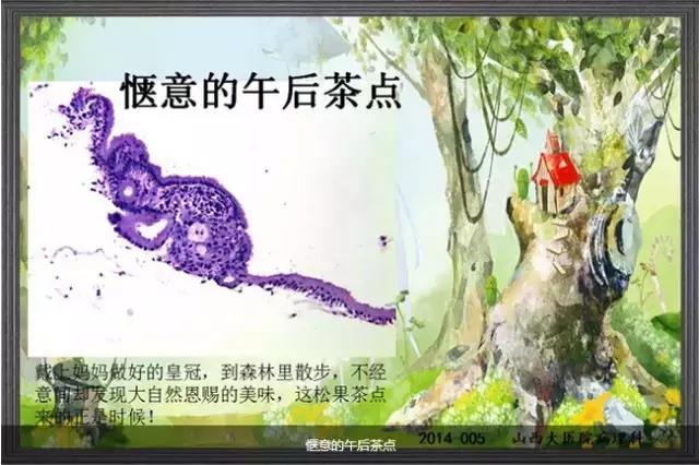 你见过这么美的病理切片吗？