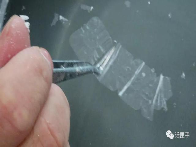 肿瘤还是囊肿?恶性还是良性?他们说了算!这群“幕后高手”,你未必了解…… 肿瘤还是囊肿?恶性还是良性?他们说了算!这群“幕后高手”,你未必了解……