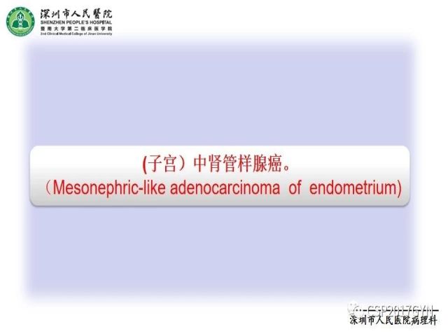 2019USCAP妇科病理热点介绍