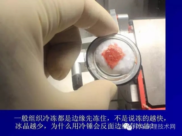 冰冻切片报告注意事项