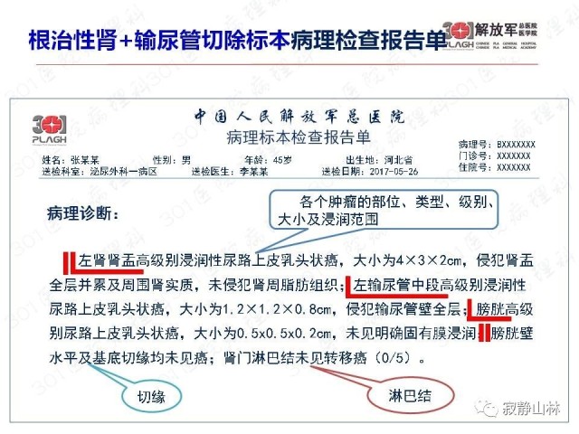 泌尿系统常见肿瘤标本病理报告规范