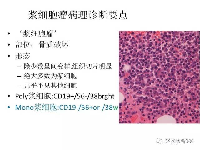 浆细胞相关肿瘤的病理诊断及鉴别诊断