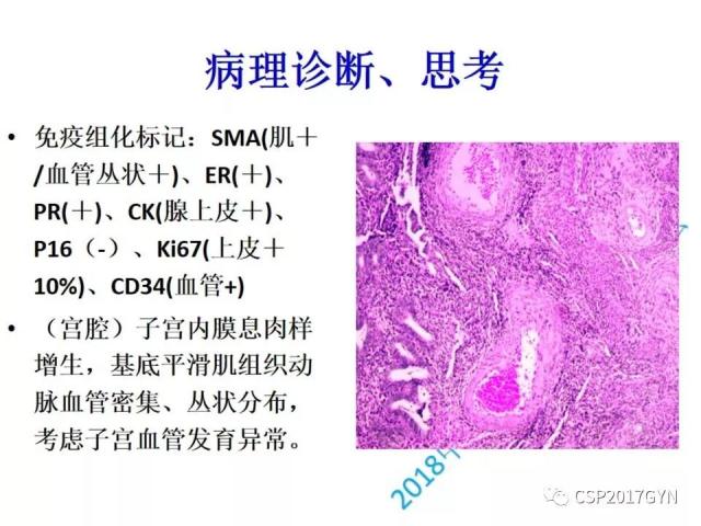 病理临床结合 开拓诊断视野