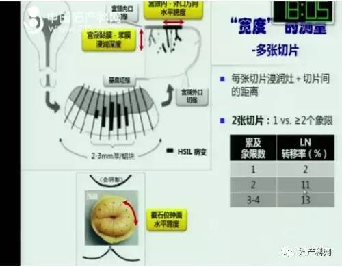 刘从容教授：如何正确解读宫颈锥切的病理报告