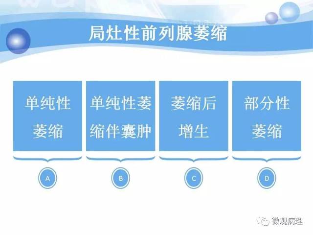 泌尿课程/局灶性前列腺萎缩