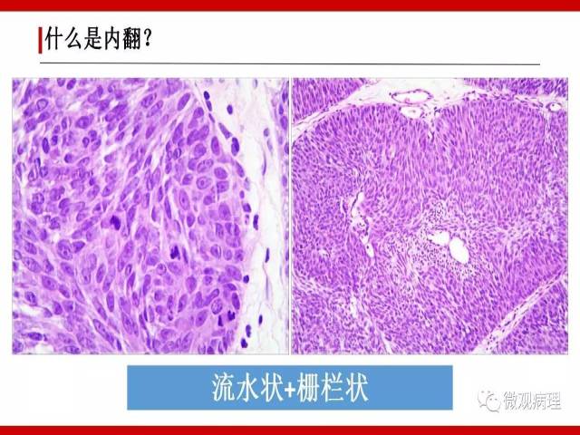 泌尿课程/尿路上皮病变的基本生长方式
