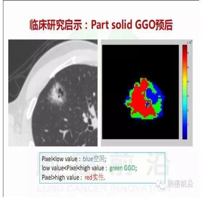 肺癌新分期和分类--临床和研究启示
