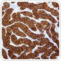 Webpathology.com-镜像翻译（自学使用，版权归原网站所有）