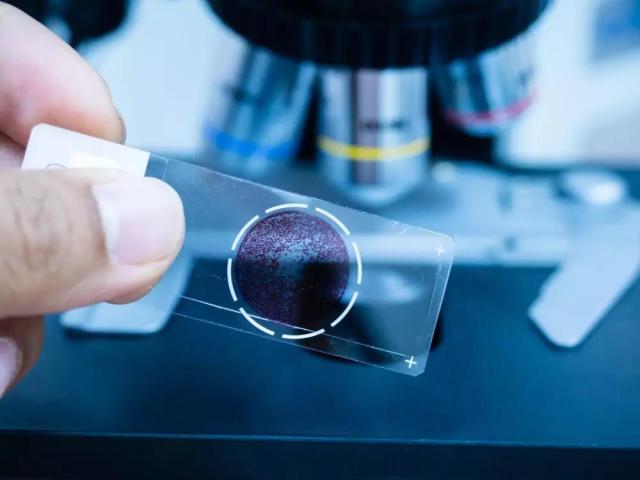 以甲状腺为例谈谈病理诊断那些事 以甲状腺为例谈谈病理诊断那些事