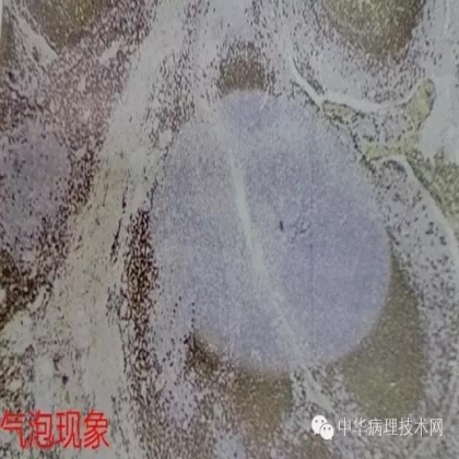 免疫组化结果的分析和常见问题的处理