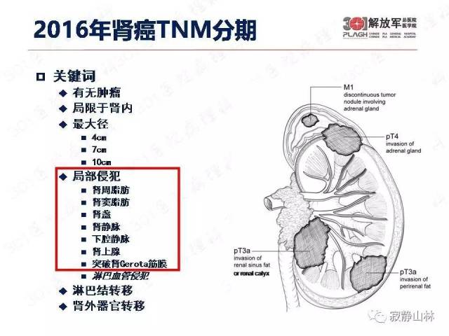 泌尿系统常见肿瘤标本病理报告规范