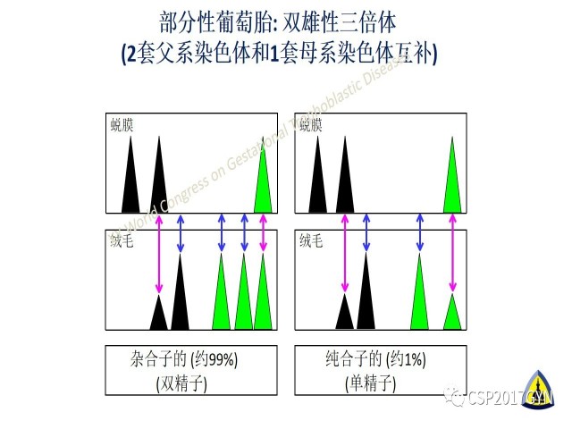 p57免疫组化染色及基因分型 在葡萄胎精确诊断中的应用
