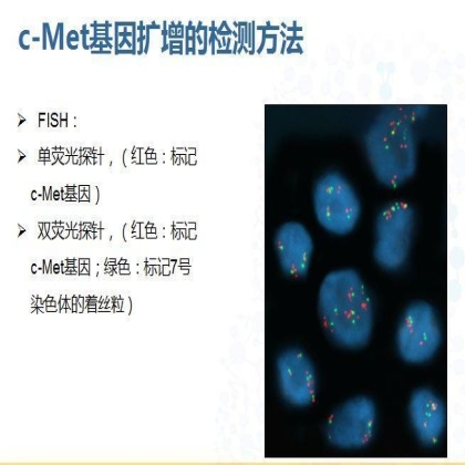 非小细胞肺癌中c-Met基因扩增FISH判读标准
