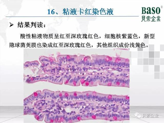 收藏:最全病理染色原理、染色流程、注意事项分享 收藏:最全病理染色原理、染色流程、注意事项分享