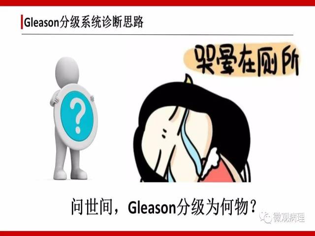 前列腺癌Gleason分级系统的前世今生