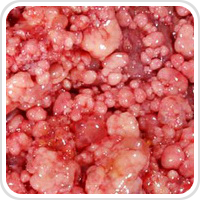 Webpathology.com-镜像翻译（自学使用，版权归原网站所有）