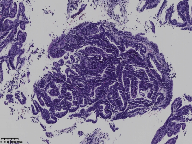 如何消除切片中的裂隙
