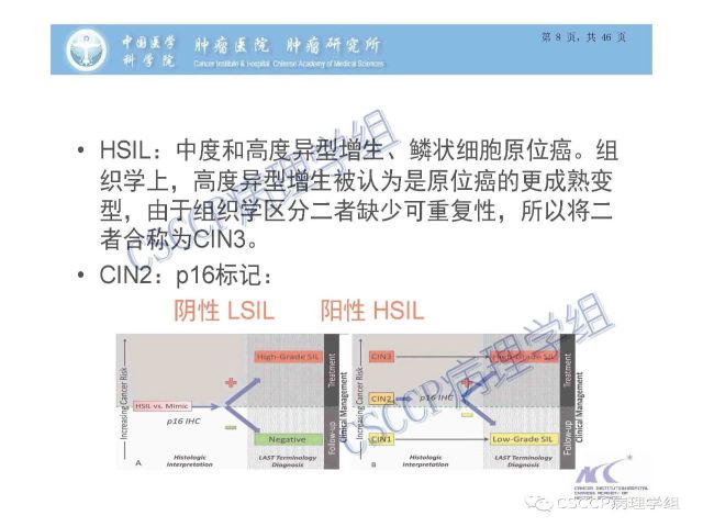 宫颈癌前病变中的诊断难点及阴道镜中ECC的 应用价值