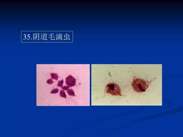 收藏！寄生虫图谱大全