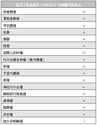 低分子量角蛋白在正常组织与肿瘤中的表达