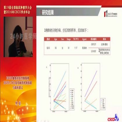 EGFR敏感突变型肺腺癌EGFR-TKIs原发耐药机制探索与临床意义