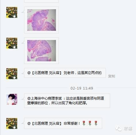 宫颈萎缩及其相关问题（李斌分享，刘从容老师讲解）