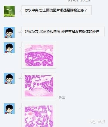 伴有筛状及乳头状结构的浸润性导管癌（水中央分享，吴焕文及孔祥田老师讲解）