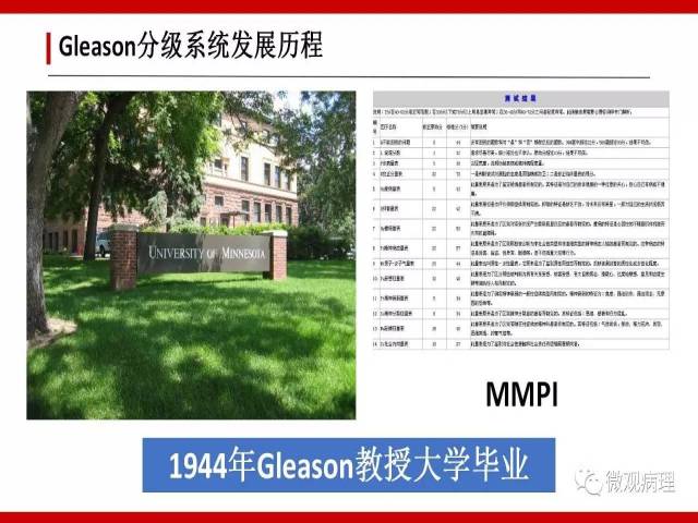 前列腺癌Gleason分级系统的前世今生