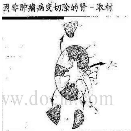 病理标本取材规范