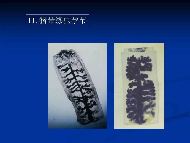 收藏！寄生虫图谱大全