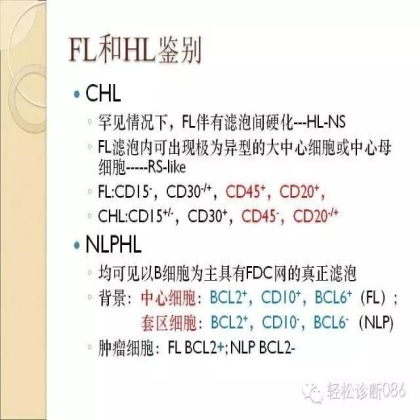 滤泡性淋巴瘤