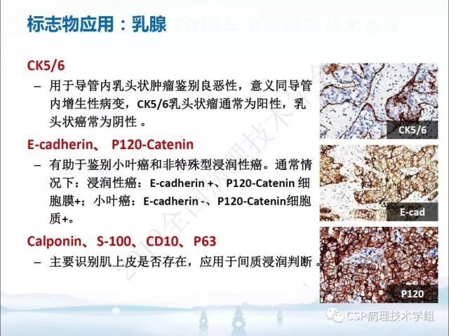 免疫组化检测的临床应用与质量评估