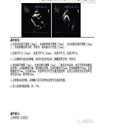 中日韩个体化诊疗案例大赛经典赏析之十三——组织活检突变阴性，血液检测EGFR19DEL,TKI 治疗PFS9个月