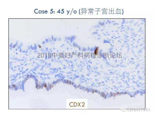 女性生殖道发育