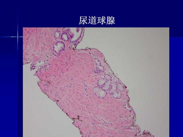 前列腺病理诊断线索（上）——黄教悌