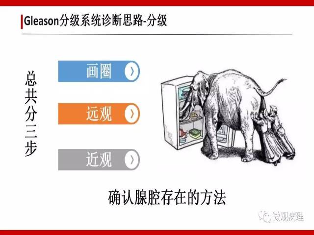 前列腺癌Gleason分级系统的前世今生